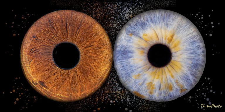 Deux yeux aux iris distincts, l'un orange et l'autre bleu, sur fond sombre étoilé.
